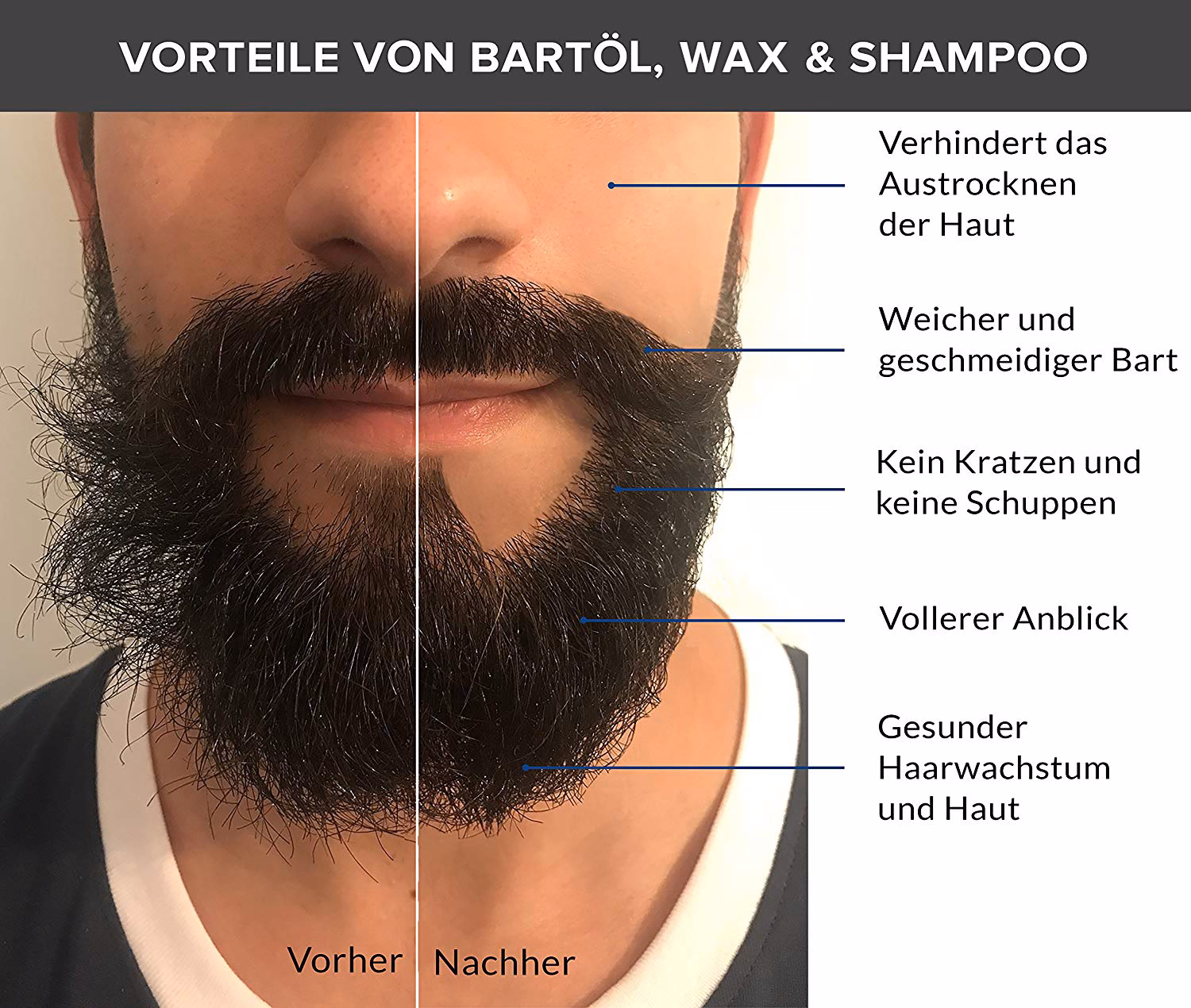 Wie bekomme ich meinen Bart weich?