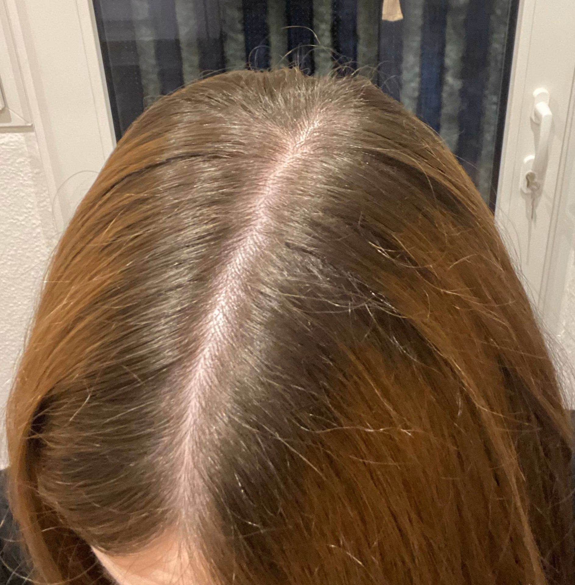 Kann man graue Haare in naturgrau umwandeln?