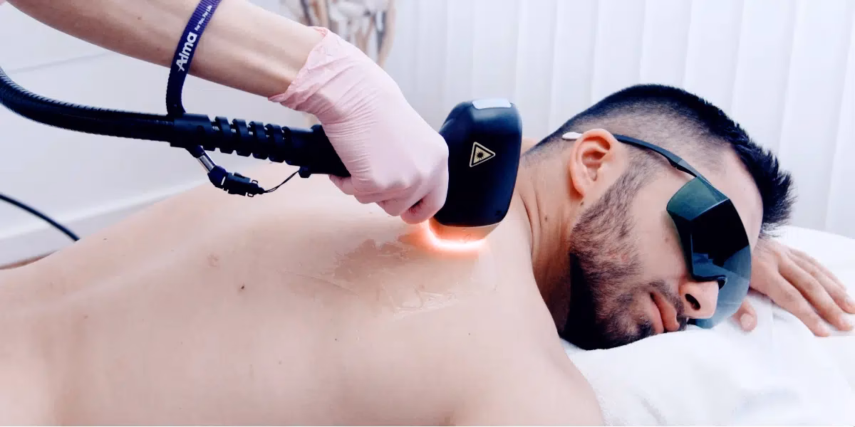 Was ist die beste dauerhafte Haarentfernung in Zürich?