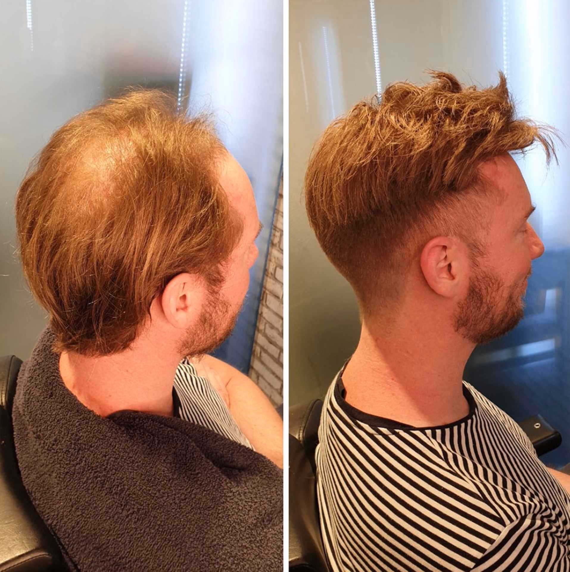 Kann man kurze Haare verlängern?