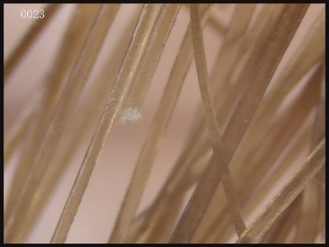 Wie reinigt man die Kopfhaut?